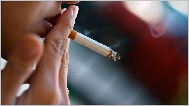 smoking as a cause of the development of varicose veins