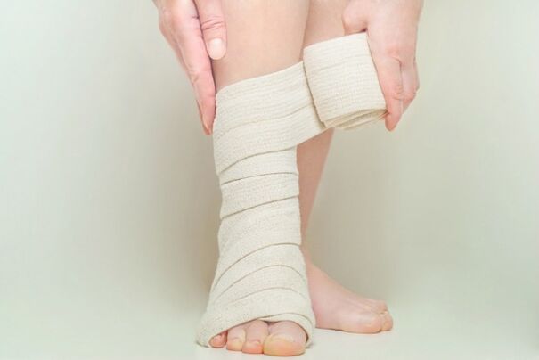 compression bandage after surgery for varicose veins