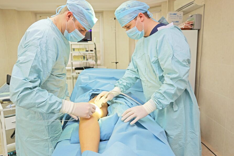 surgery for varicose veins of the small pelvis