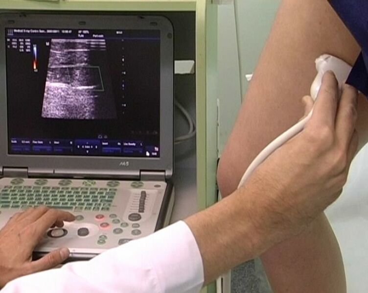 ultrasound diagnosis of pelvic varicose veins