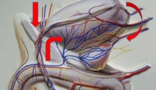 varicose veins of the pelvis