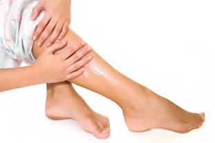 Symptoms of varicose veins of the legs in women